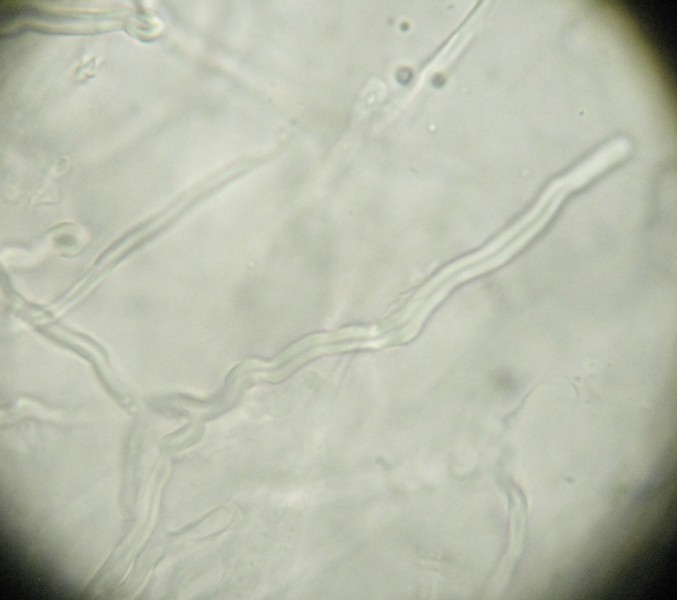 Antrodia? (Antrodia alpina)